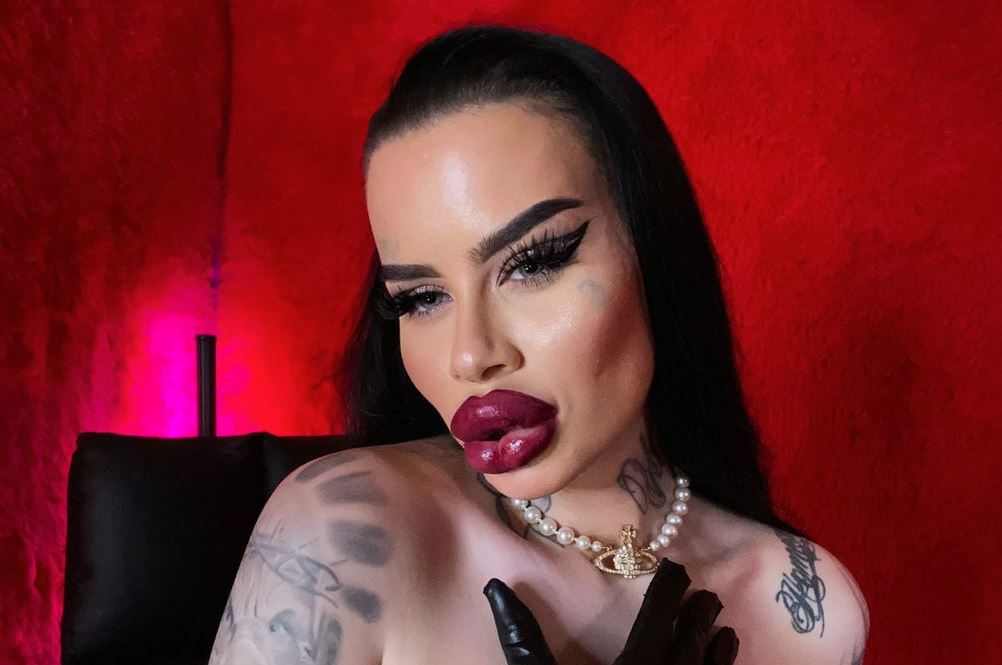 Wanita Austria Fetisch Barbie Membelanjakan RM214,924 Untuk Membesarkan Bibir